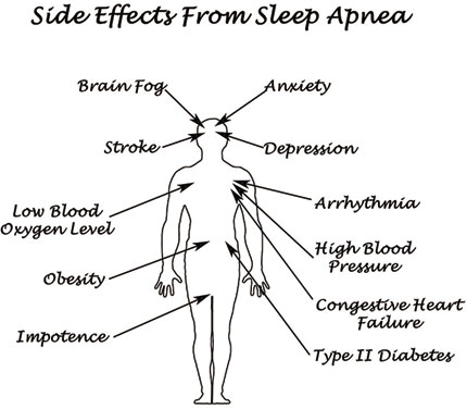 side effectsfrom sleep apnea